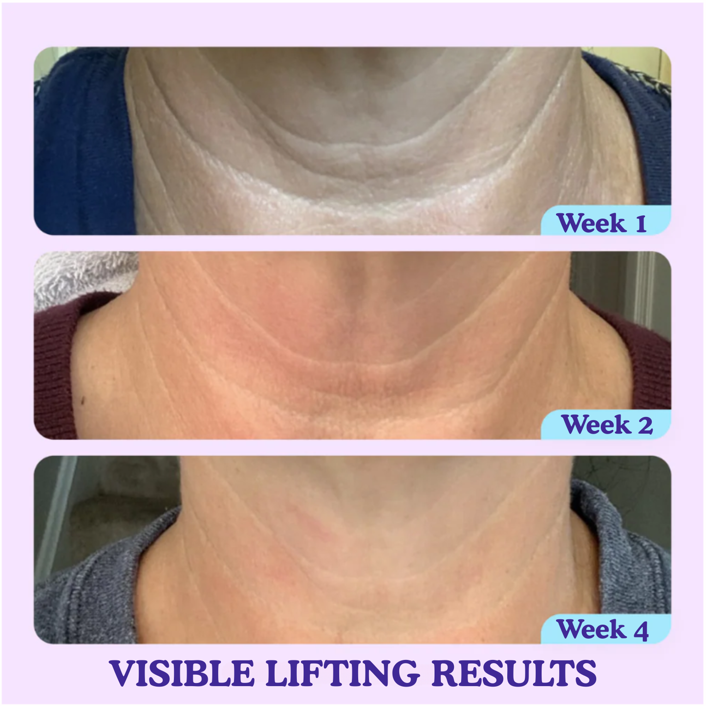 PureLift™ – Tighten & Lift Neck Cream