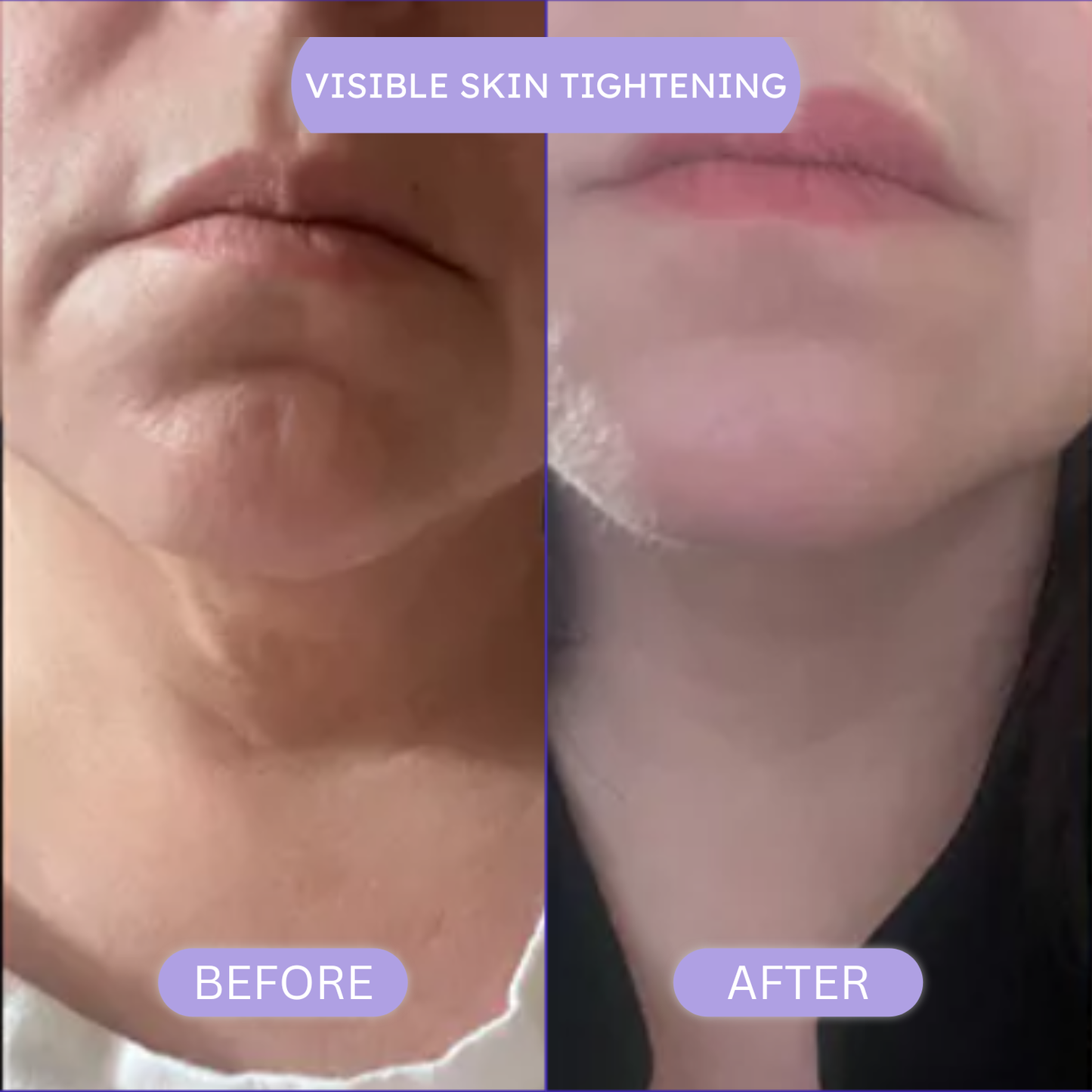 PureLift™ – Tighten & Lift Neck Cream