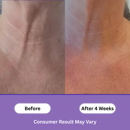 PureLift™ – Tighten & Lift Neck Cream