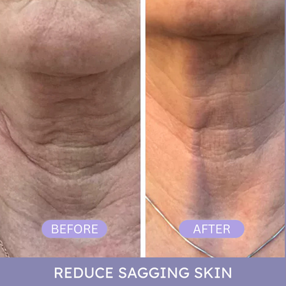 PureLift™ – Tighten & Lift Neck Cream