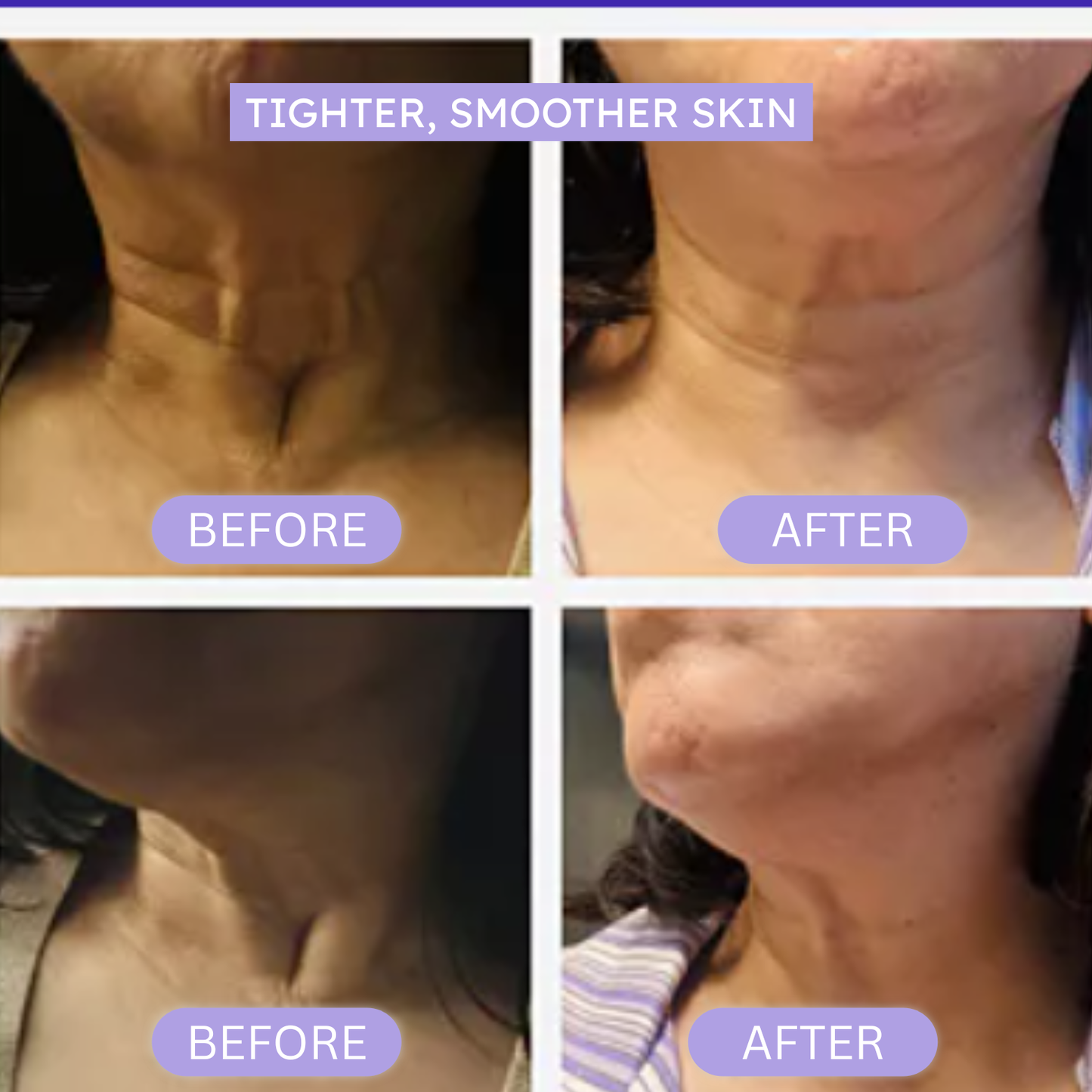 PureLift™ – Tighten & Lift Neck Cream