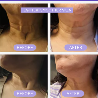 PureLift™ – Tighten & Lift Neck Cream