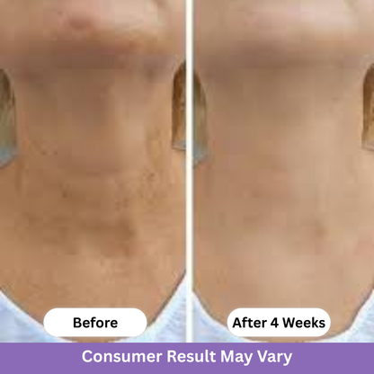 PureLift™ – Tighten & Lift Neck Cream